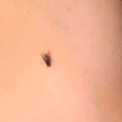 A housefly on Kabutroid's arm